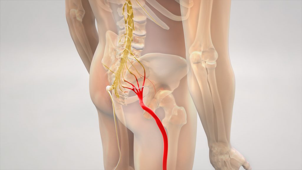 Massage Therapy for Sciatica Nerve Pain Relief
